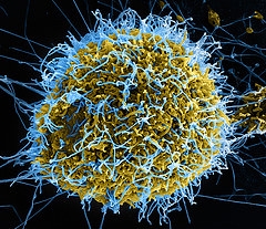 Itthon is felkészültek az Ebola-vírus kimutatására