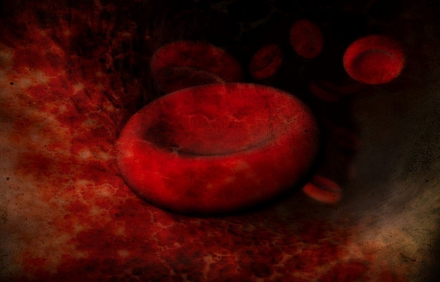 hemolitikus vérszegénység és fogyás