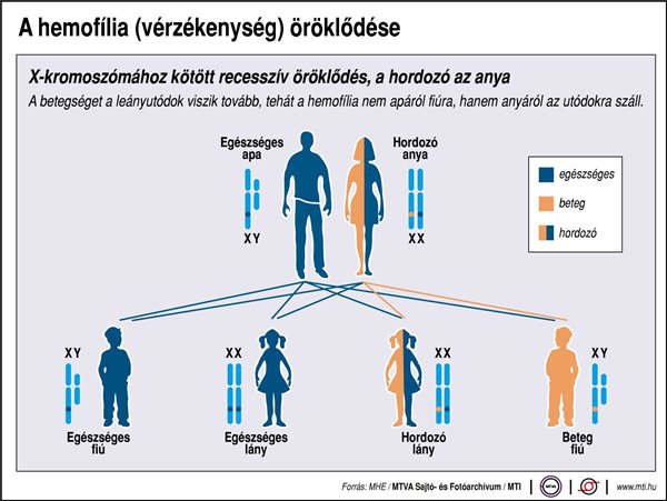 A hemofília (vérzékenység) öröklődése