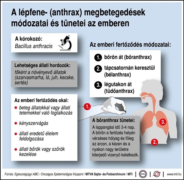 Lépfene - Hazaengedték a kórházból az egyetlen Heves megyei beteget