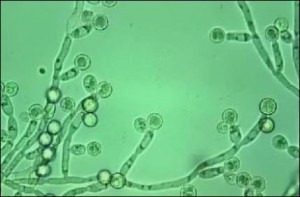 candidiasis és merevedés