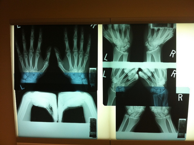 A Zalaegerszegi kórház új röntgen- és MRI-berendezések beszerzéséhez kapott forrásokat