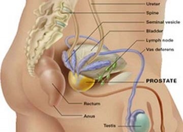 balanit a prosztatitisből prostatita cronica